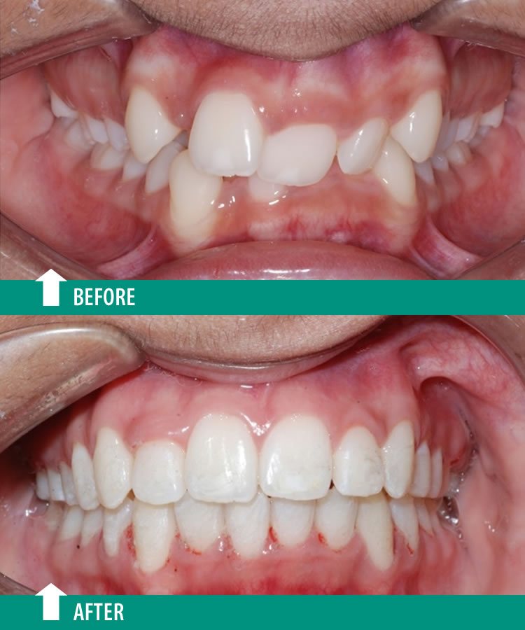 Orthodontist, Dr. Gagan Bhalla dental clinic in Mississauga - Photo 7