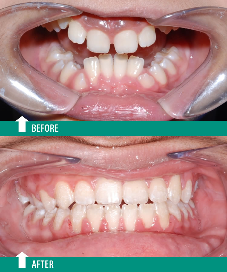 Orthodontist, Dr. Gagan Bhalla dental clinic in Mississauga - Photo 8