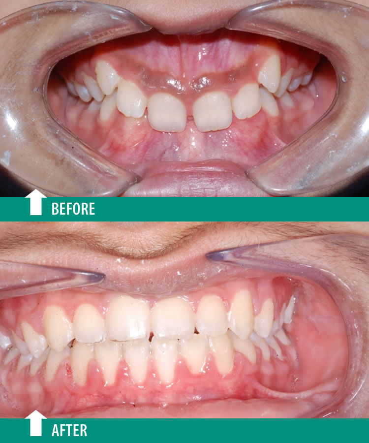 Orthodontist, Dr. Gagan Bhalla dental clinic in Mississauga - Photo 9