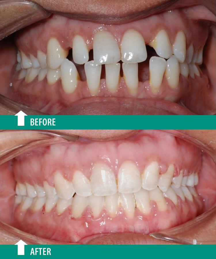Orthodontist, Dr. Gagan Bhalla dental clinic in Mississauga - Photo 10
