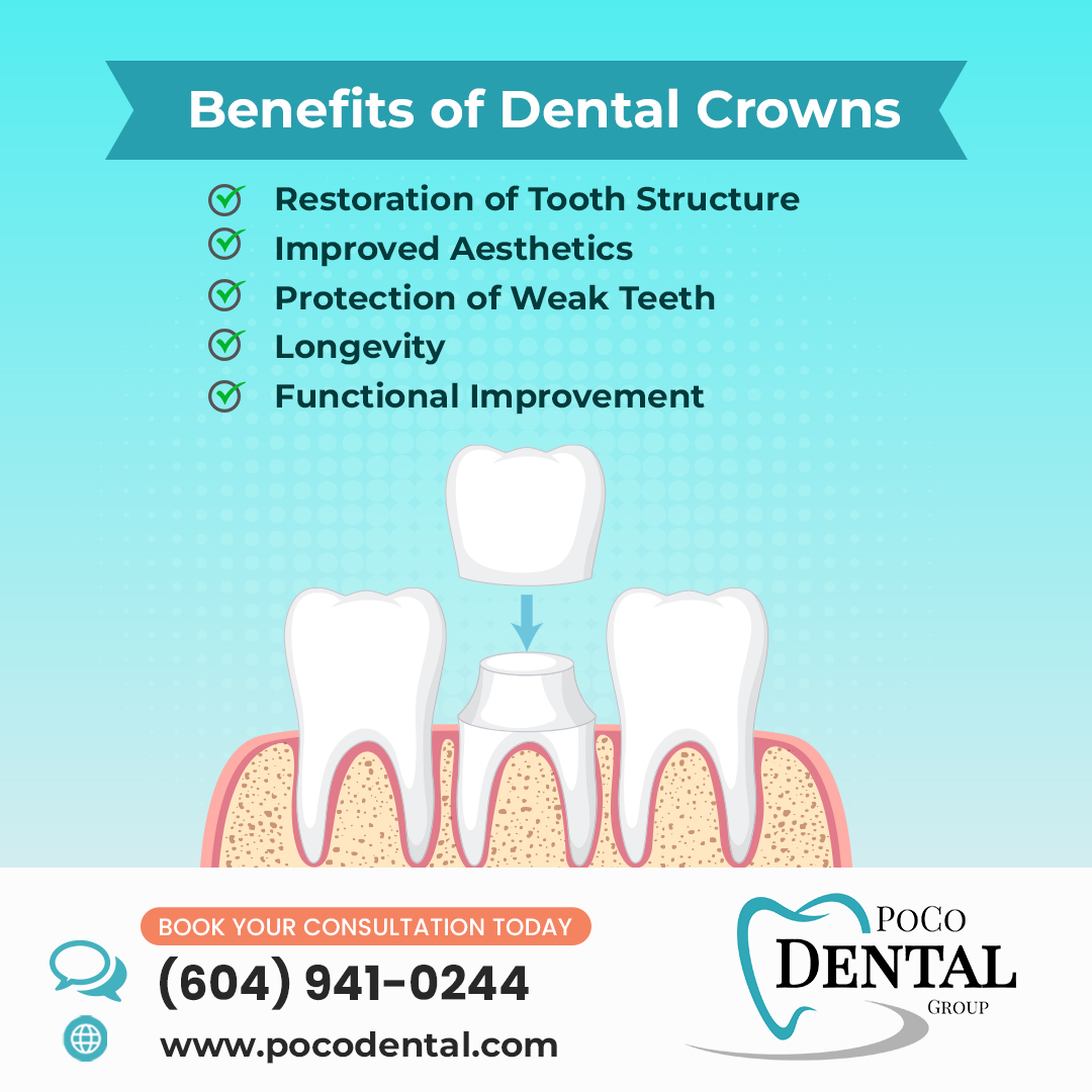 PoCo Dental Group dental clinic in Port Coquitlam - Photo 7