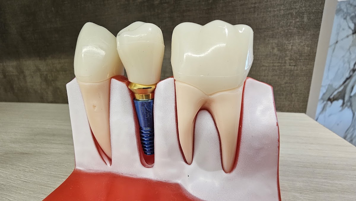 Rock Dental dental clinic in White Rock - Photo 9