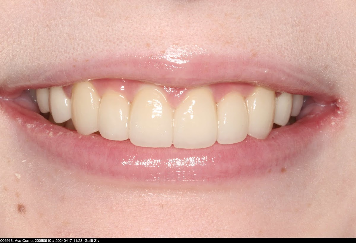 Newton Dental Group - Surrey dental clinic in Surrey - Photo 6