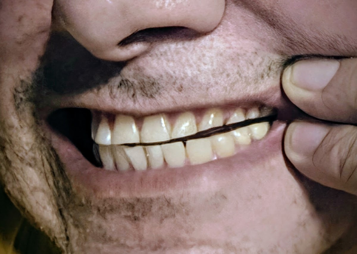Gateway Dental Centre dental clinic in Surrey - Photo 9