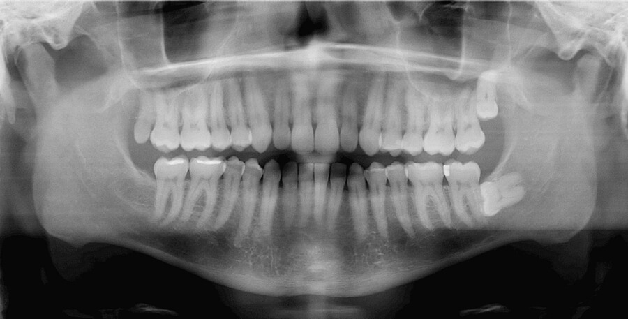Dentistry Thirty Two dental clinic in Maple Ridge - Photo 4