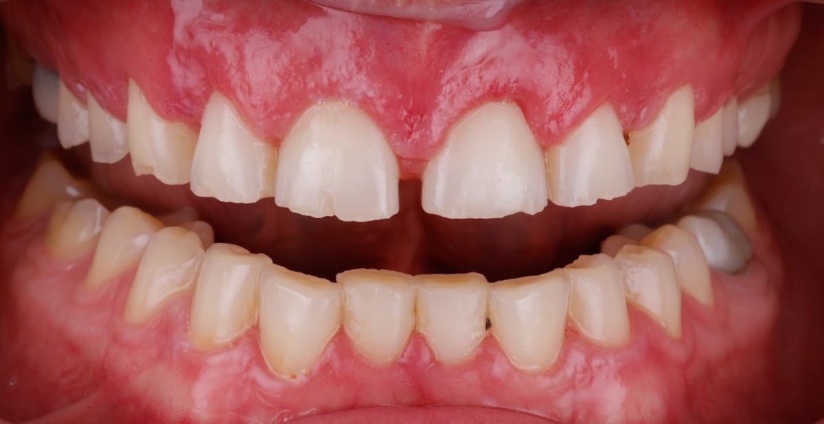 Elevation Dental dental clinic in Coquitlam - Photo 9