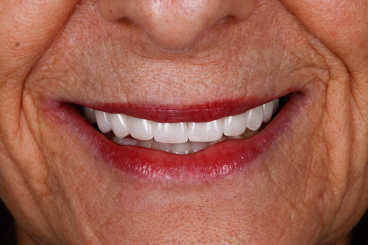 Elevation Dental dental clinic in Coquitlam - Photo 10
