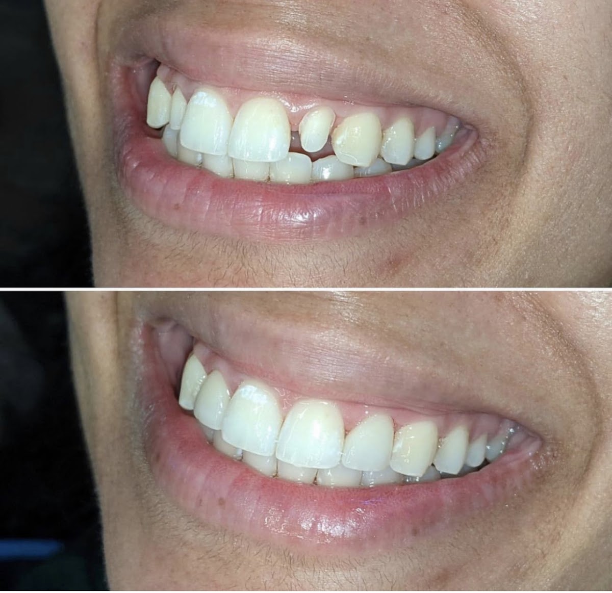 Oasis Dental Studio dental clinic in Coquitlam - Photo 5