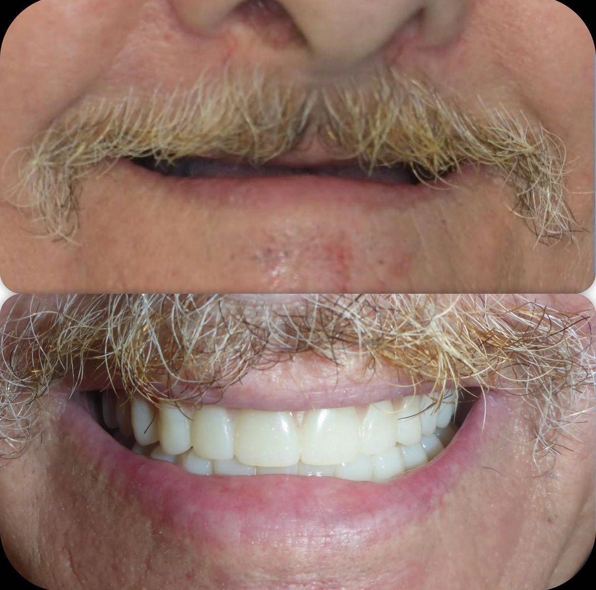 Langley Dental Group dental clinic in Langley Township - Photo 8