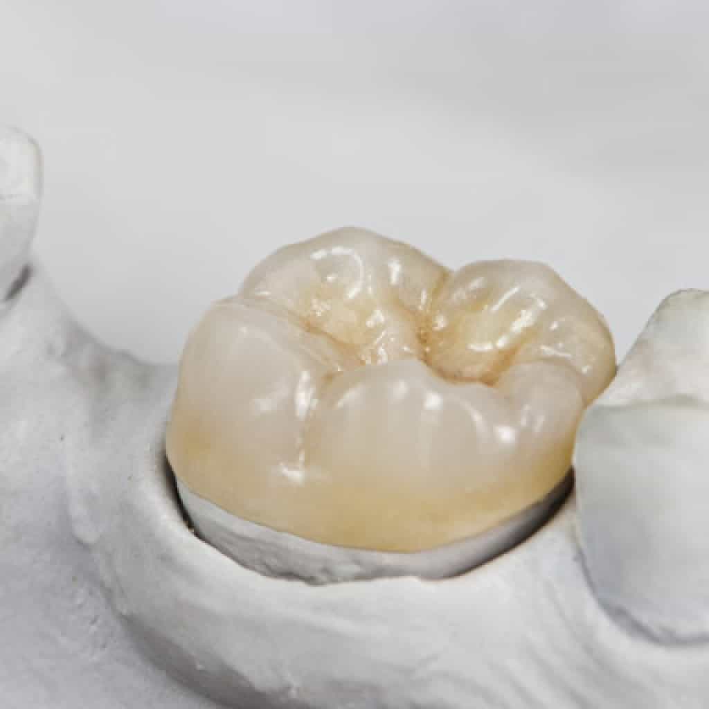 Amazing Smile Dental dental clinic in Langley - Photo 6