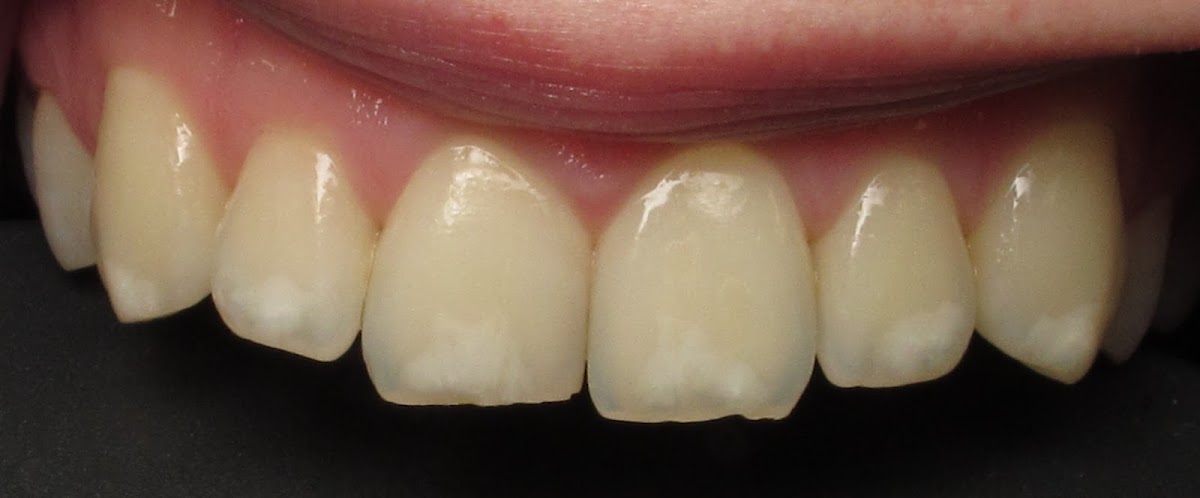 Align Dental Centre dental clinic in Abbotsford - Photo 6