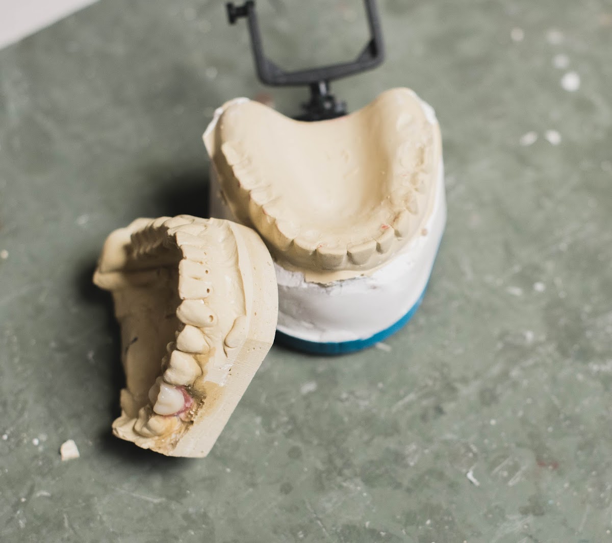 NOVO Dental Centre dental clinic in Abbotsford - Photo 6