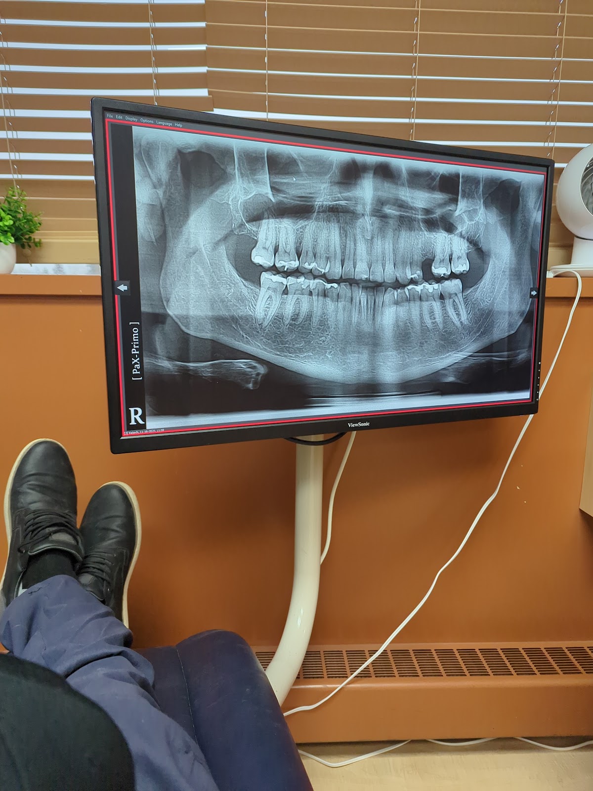Lifetime Dental dental clinic in Abbotsford - Photo 7