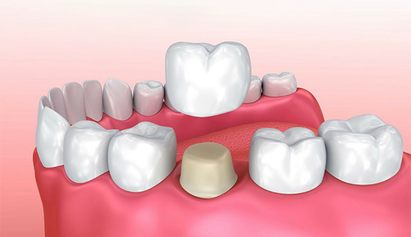 Novacare Dental Langley dental clinic in Langley - Photo 4