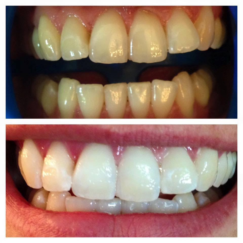 Novacare Dental Langley dental clinic in Langley - Photo 5