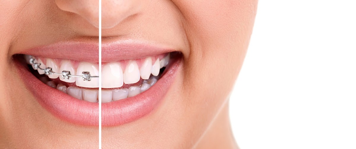 London Braces dental clinic in London - Photo 4