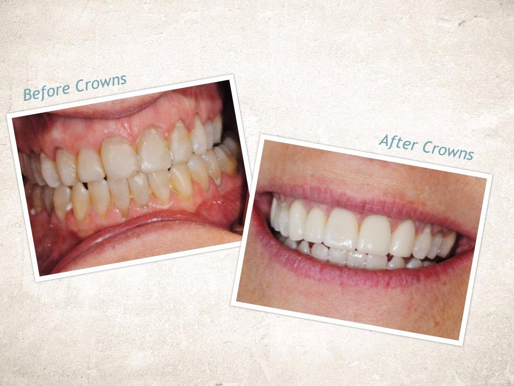 Midtown Kelowna Dental dental clinic in Kelowna - Photo 4
