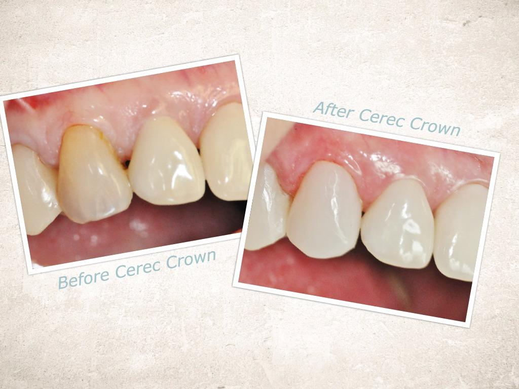 Midtown Kelowna Dental dental clinic in Kelowna - Photo 9