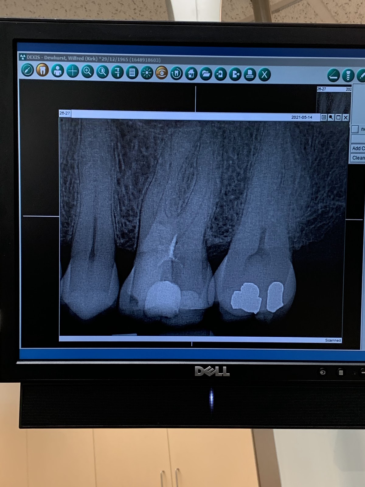 Jasper Avenue Dental dental clinic in Edmonton - Photo 6