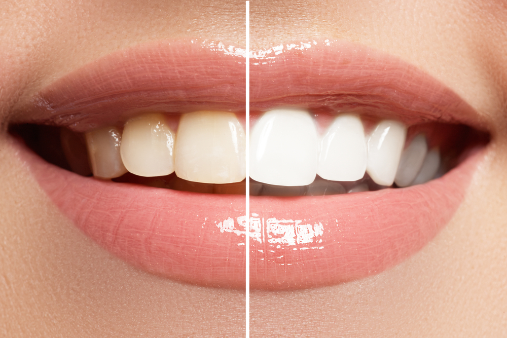 Refresh Dental dental clinic in Edmonton - Photo 10