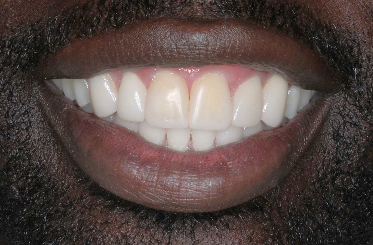 Toothworks Dentistry Downtown Edmonton dental clinic in Edmonton - Photo 6