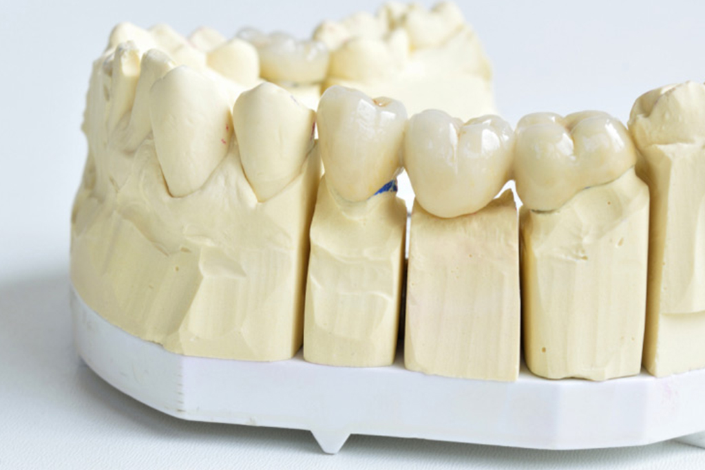 Midtown Smiles Dental Care | Dr. Anil Shetty dental clinic in Kitchener - Photo 5