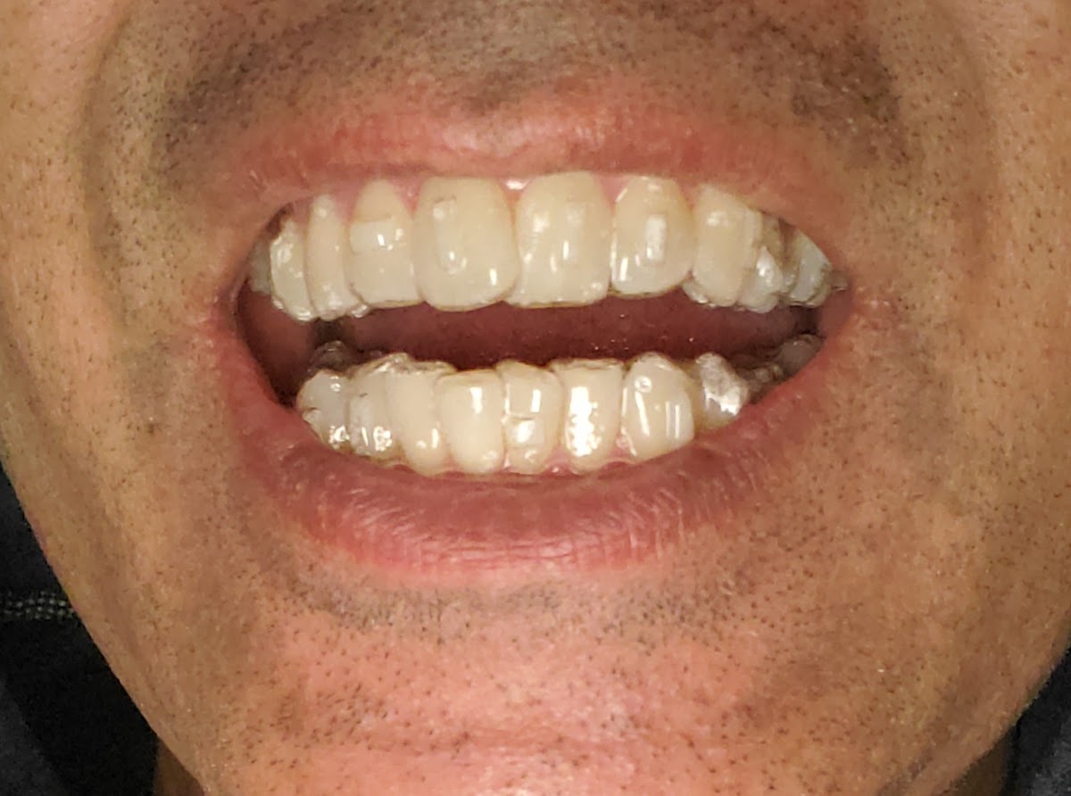 Smile Zone dental clinic in Edmonton - Photo 10