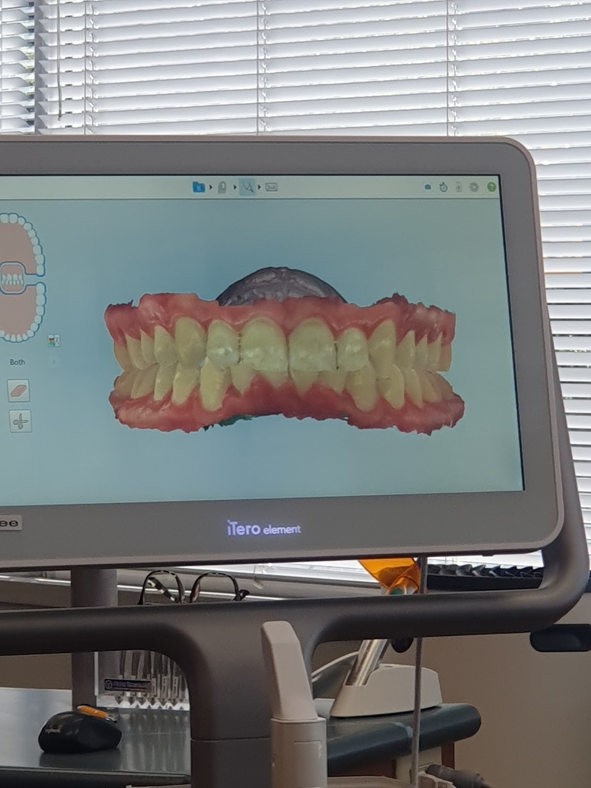 Westview Orthodontics dental clinic in North Vancouver - Photo 5