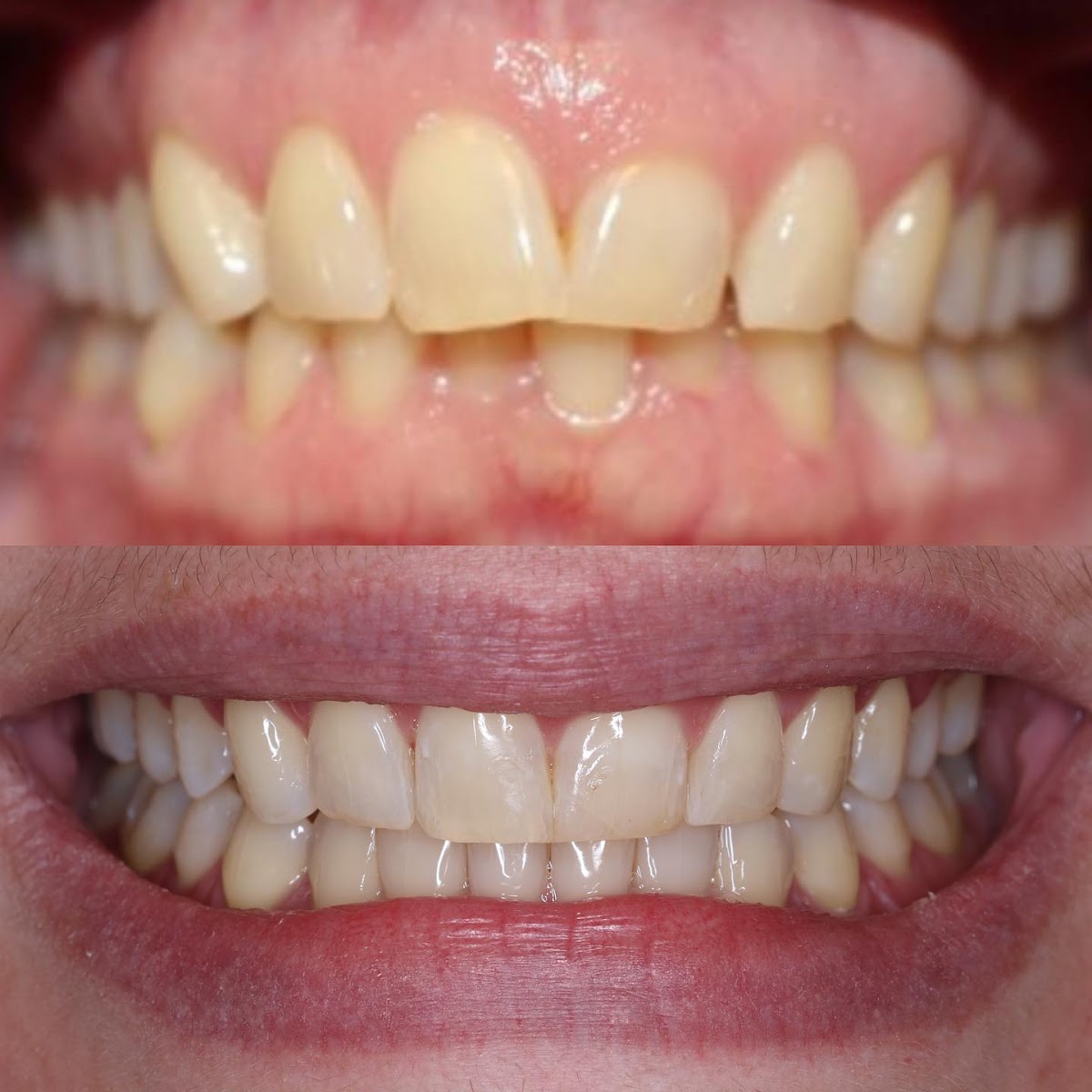 South Airdrie Smiles dental clinic in Airdrie - Photo 8