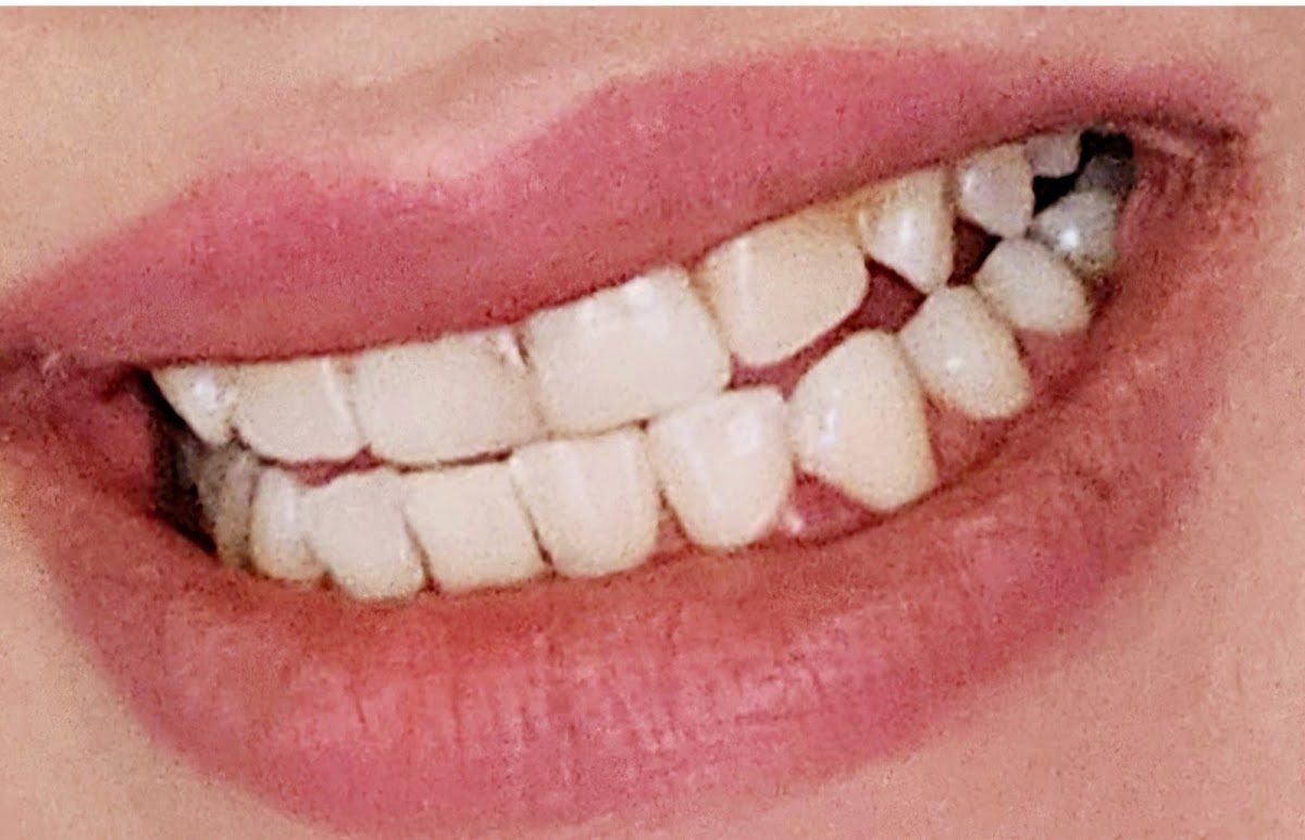 Smileville Dental dental clinic in Calgary - Photo 10