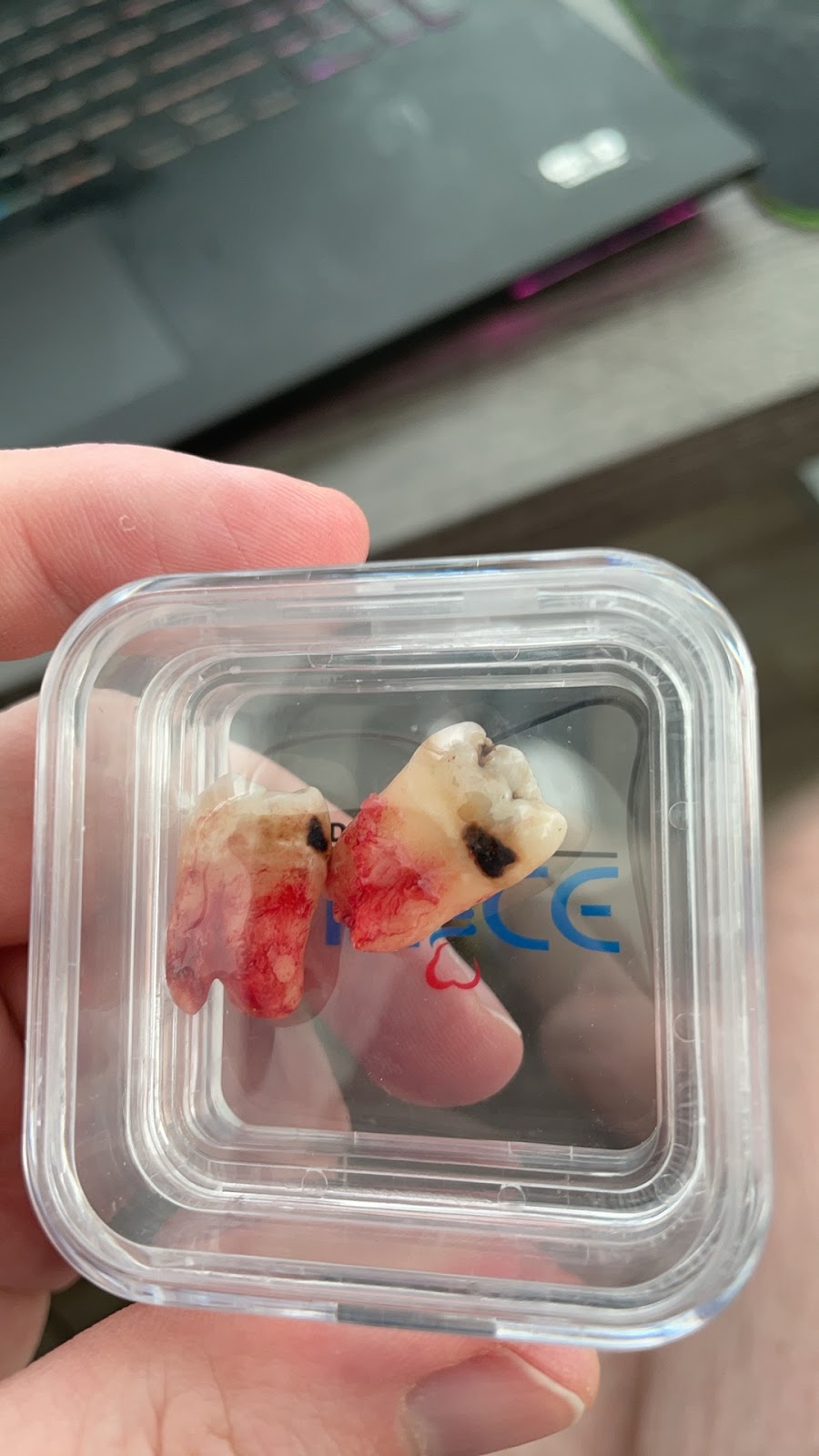 8 West Dental Care dental clinic in Calgary - Photo 8