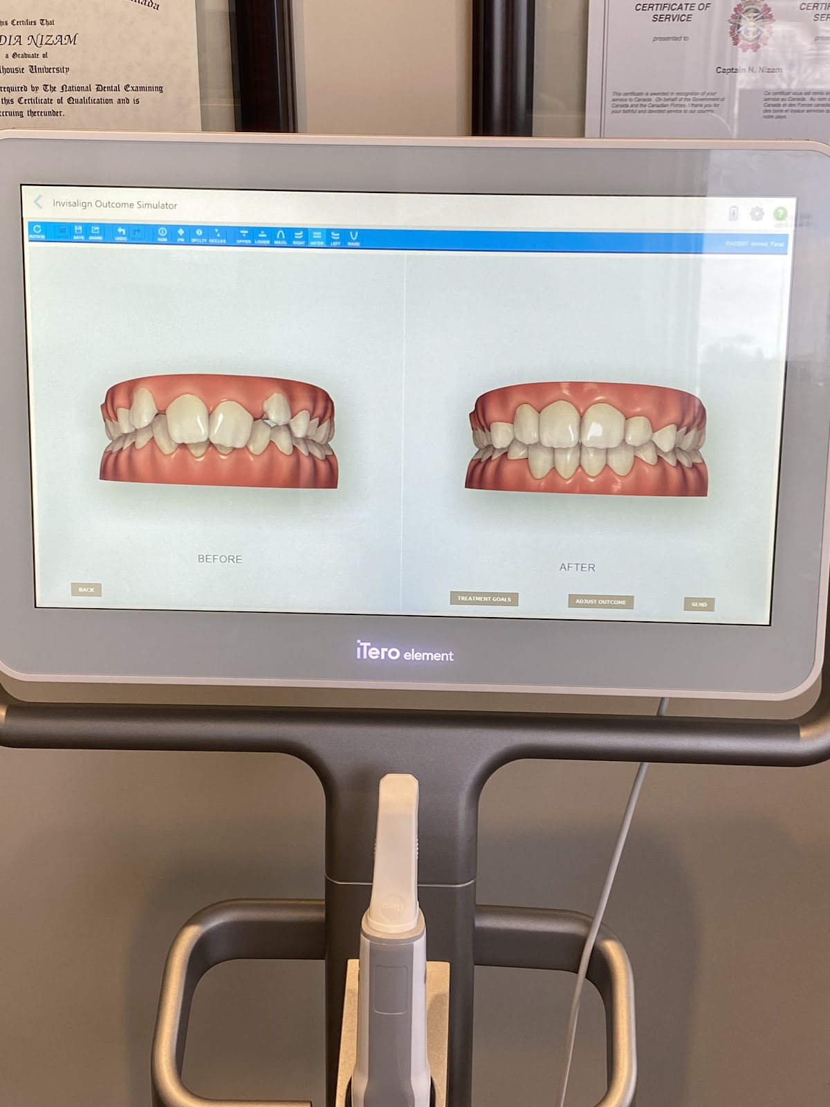 Impressions Orthodontics dental clinic in Calgary - Photo 3