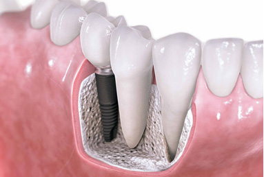 Kaplan Dental Clinic dental clinic in Old Toronto - Photo 7