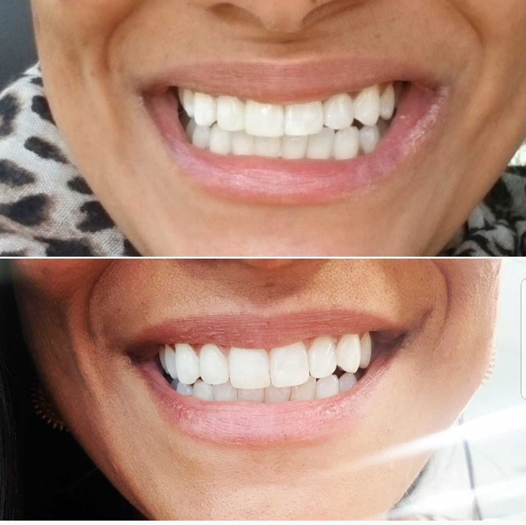 Ambiance Dental Calgary dental clinic in Calgary - Photo 8