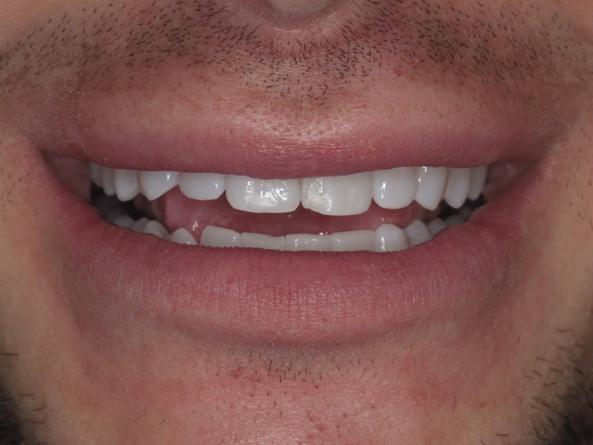 Ambiance Dental Calgary dental clinic in Calgary - Photo 9