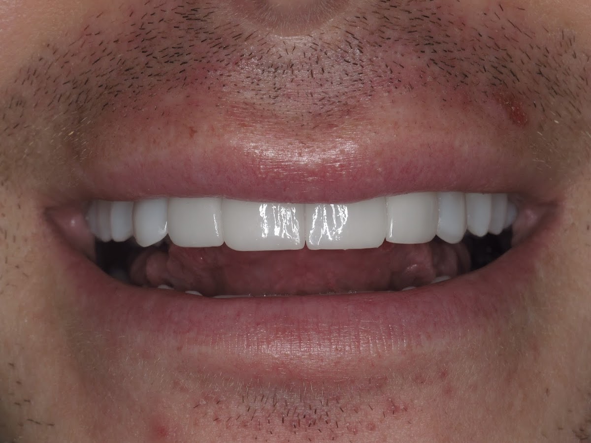 Ambiance Dental Calgary dental clinic in Calgary - Photo 10