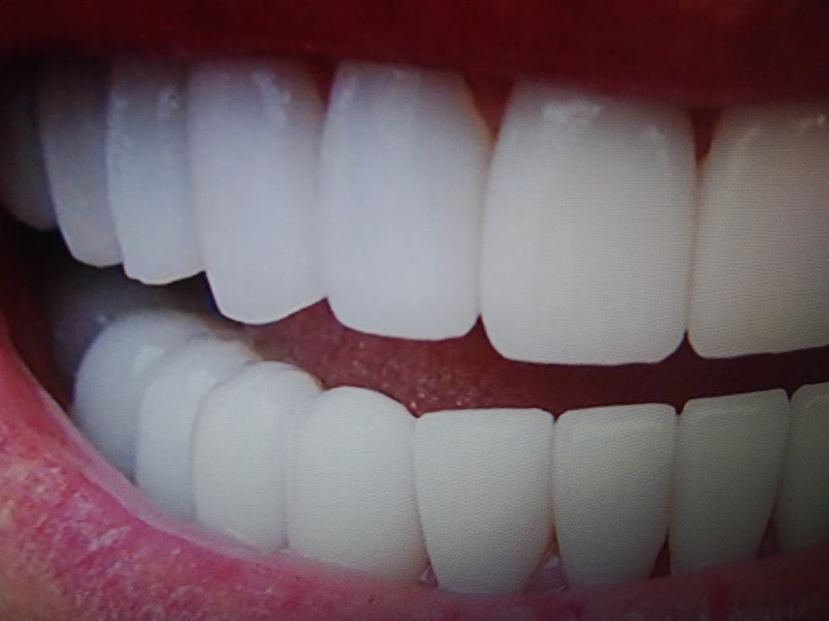 Stoney Trail Dental dental clinic in Calgary - Photo 9