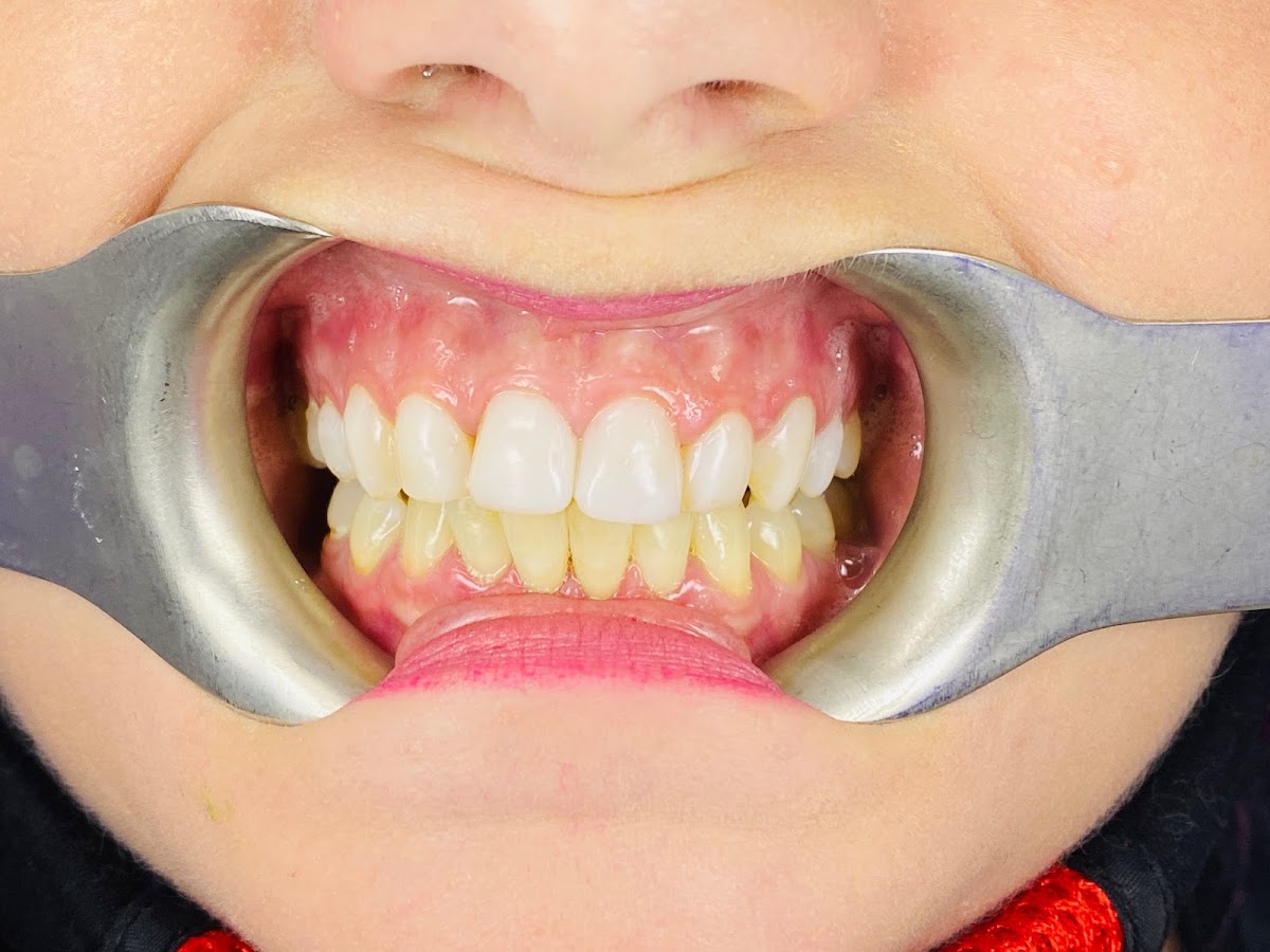 Galt Dental Care dental clinic in Cambridge - Photo 6