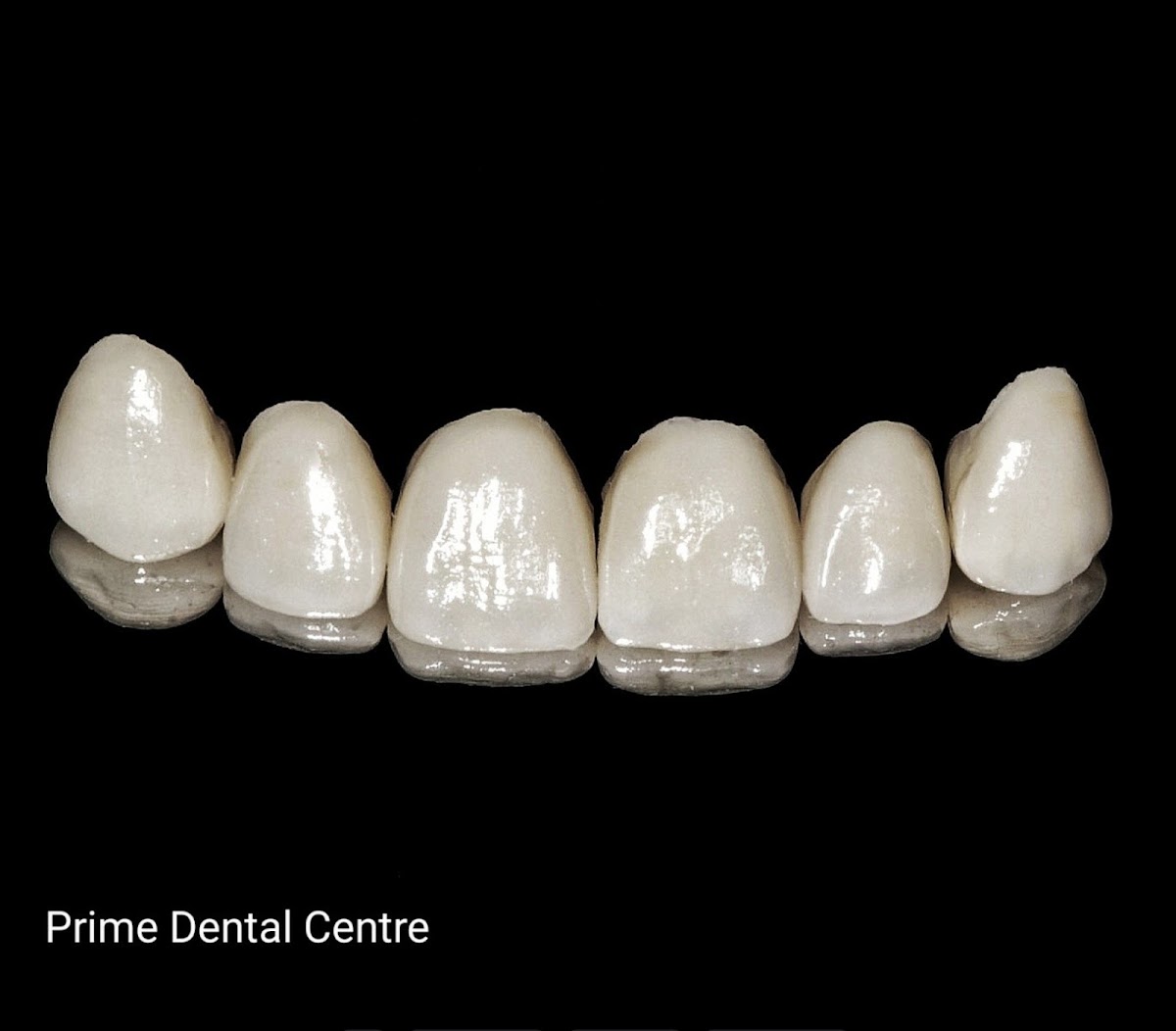 Prime Dental Centre dental clinic in Surrey - Photo 8