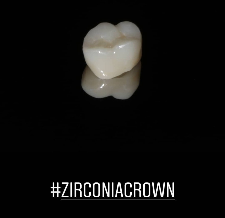 Prime Dental Centre dental clinic in Surrey - Photo 9