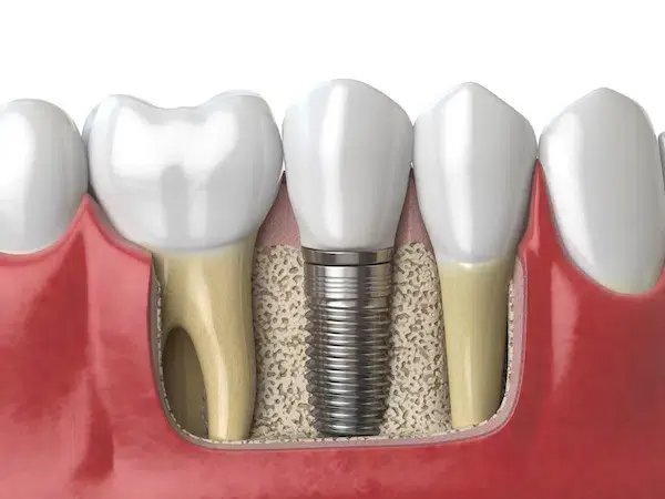 Rocky Ridge Dental dental clinic in Calgary - Photo 10