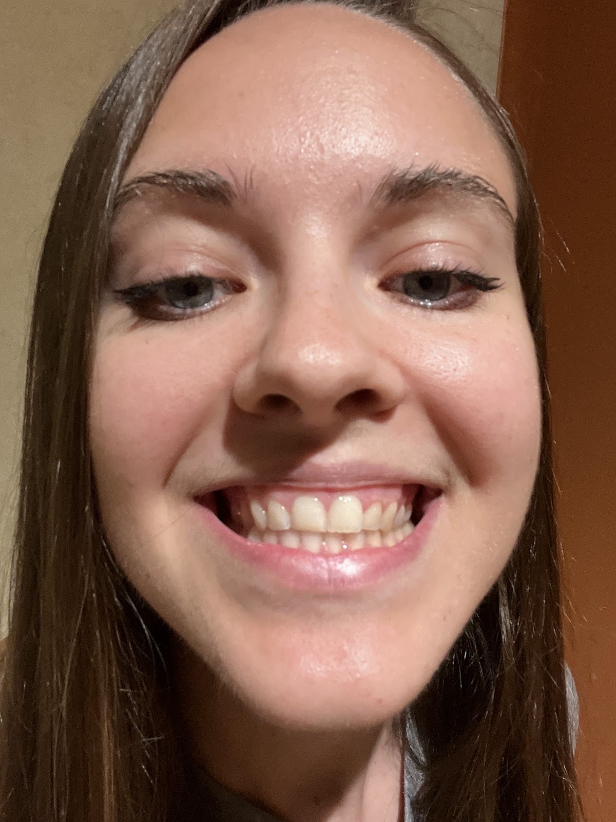Dr. Tyler Crowe dental clinic in Victoria - Photo 5