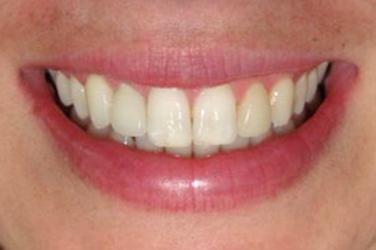 Tyler Dental Artz dental clinic in Mission - Photo 6