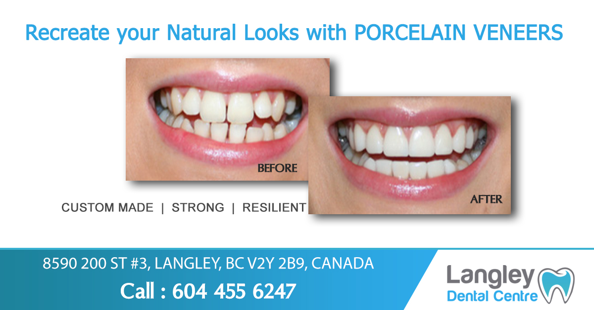 Langley Dental Centre dental clinic in Langley - Photo 6
