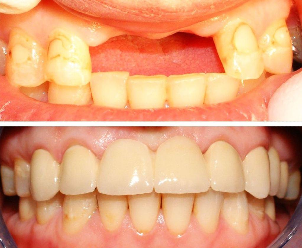 Sunrise Dental Clinic - Coquitlam Dentist dental clinic in Coquitlam - Photo 5
