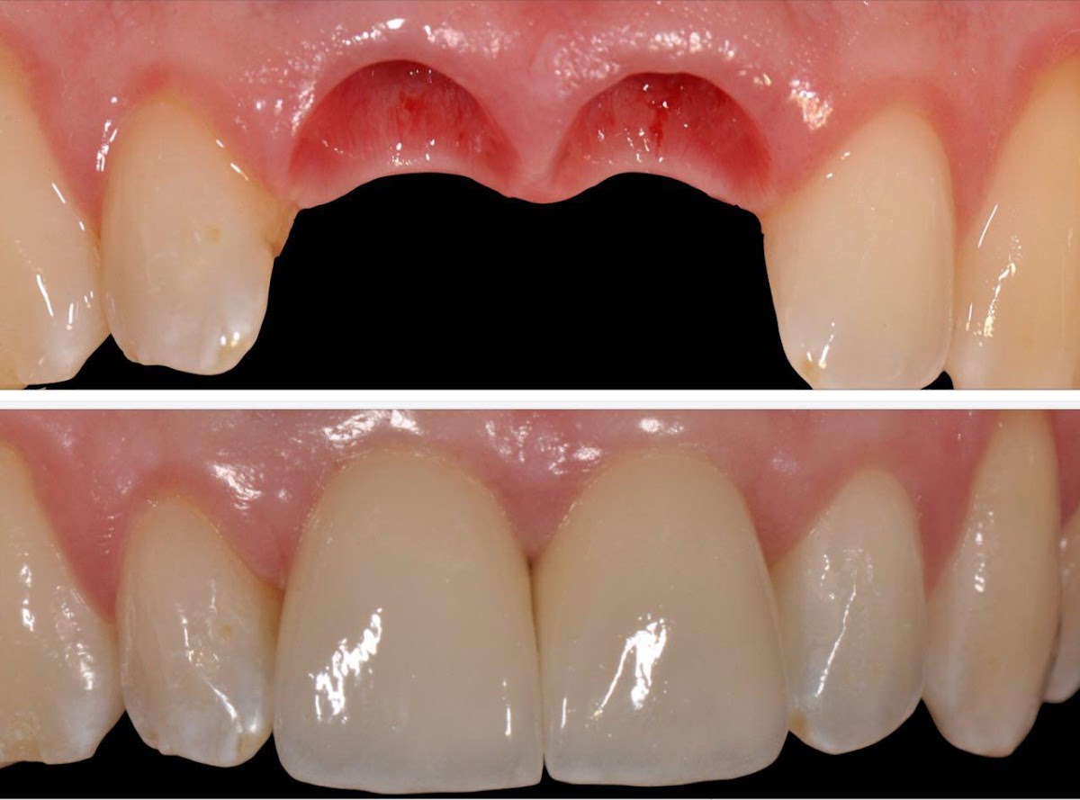 Pape Dental Centre - Dental Clinic Danforth dental clinic in Toronto - Photo 9