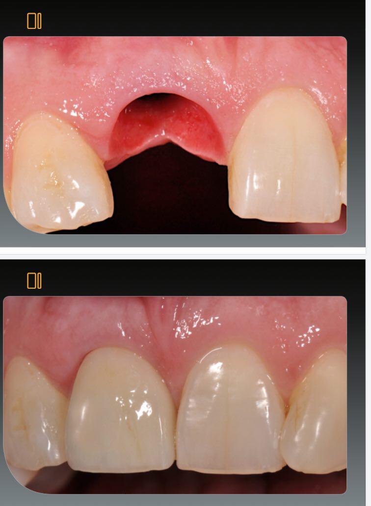 Pape Dental Centre - Dental Clinic Danforth dental clinic in Toronto - Photo 10